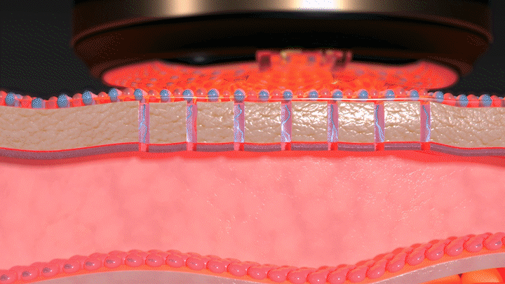 상세페이지 11 갈바닉