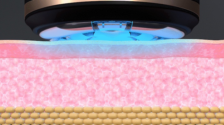 상세페이지 13 LED