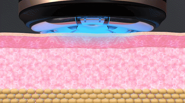 상세페이지 20 EV