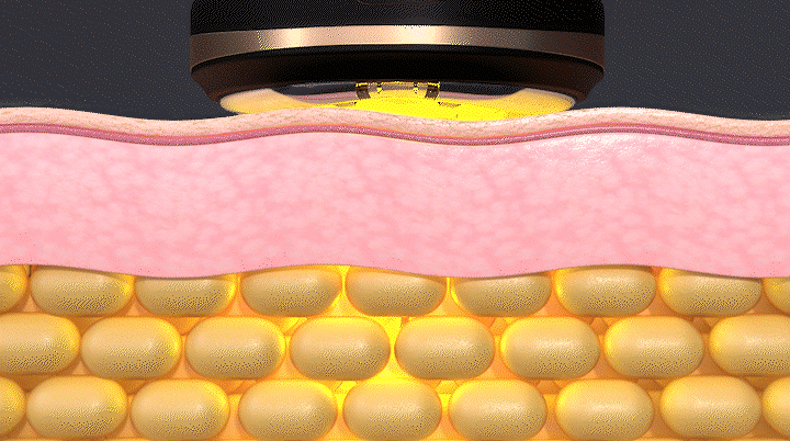 상세페이지 4 초음파