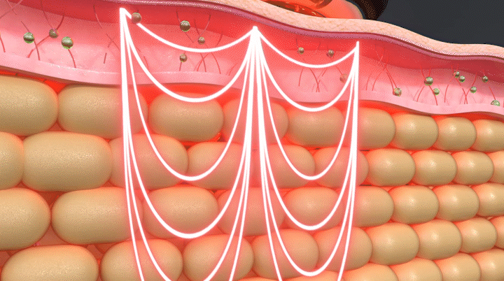 상세페이지 7 RF